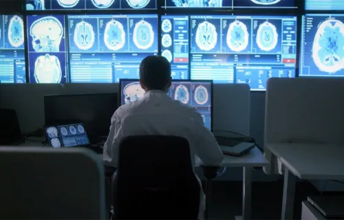 Tekoäly tunnistaa nyt aivoverenvuodot: AI Head Analysis uudistaa diagnostiikan ja hoidon. Kuvassa lääkäri tutkii pään tietokonetomografiakuvia. 